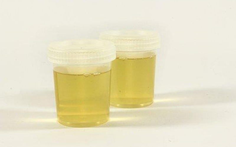What Is Synthetic Urine? And Everything You Need to Know About It